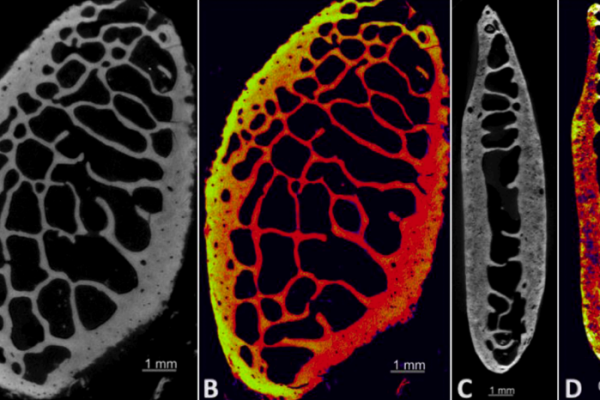 An Investigation of Micro-CT Analysis of Bone as a New Diagnostic Method for Paleopathological Cases of Osteomalacia